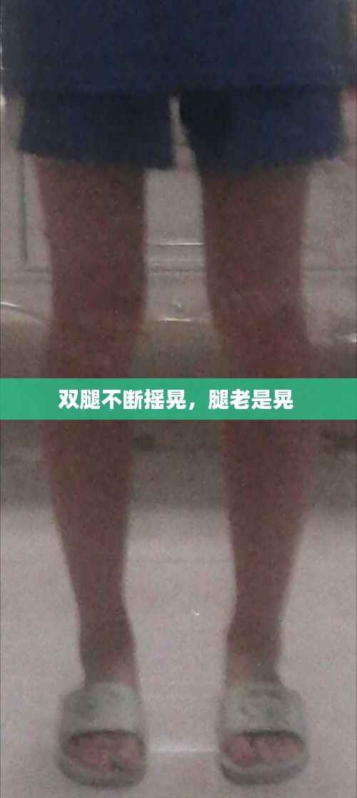 双腿不断摇晃,腿老是晃